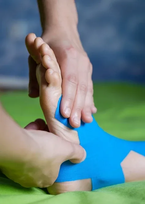 Application of blue kinesiology tape to a foot in North Vancouver.